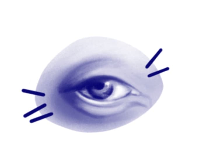 eye rotterdam